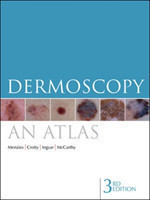Dermoscopy - Atlas