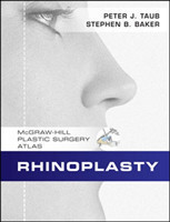 Rhinoplasty