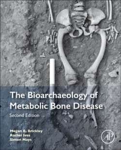 Bioarchaeology of Metabolic Bone Disease