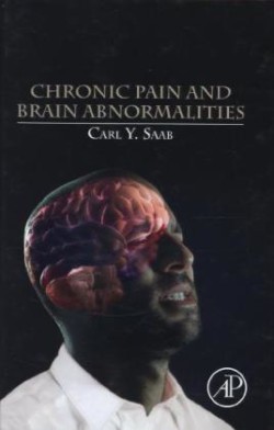 Chronic Pain and Brain Abnormalities