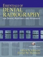 Essentials of Dental Radiography for Dental Assistants and Hygienists