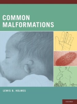 Common Malformations