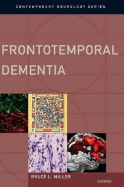 Frontotemporal Dementia