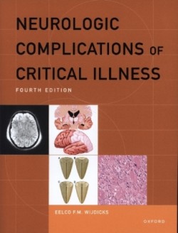 Neurologic Complications of Critical Illness