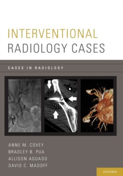 Interventional Radiology Cases