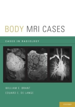 Body MRI Cases
