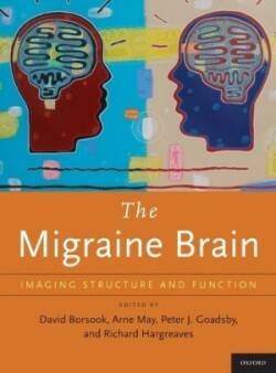 Migraine Brain