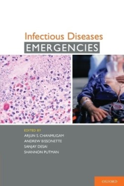 Infectious Diseases Emergencies