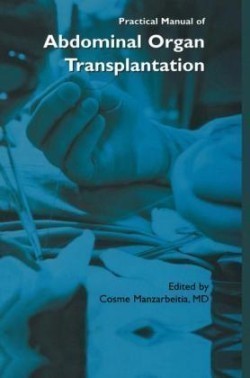 Practical Manual of Abdominal Organ Transplantation