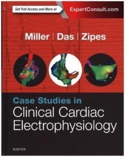Case Studies in Clinical Cardiac Electrophysiology