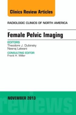 Female Pelvic Imaging, An Issue of Radiologic Clinics of North America