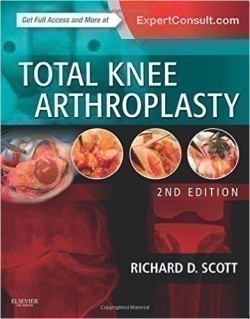 Total Knee Arthroplasty, 2nd Ed.