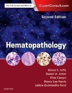 Hematopathology, 2nd Ed.
