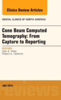 Cone Beam Computed Tomography: From Capture to Reporting, An Issue of Dental Clinics of North America