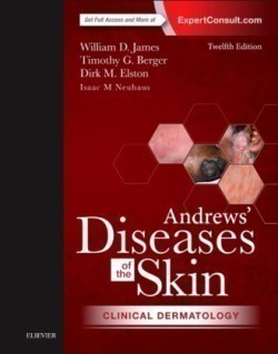 Andrews' Diseases of the Skin Clinical Dermatology
