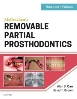 McCracken's Removable Partial Prosthodontics, 13th Ed.