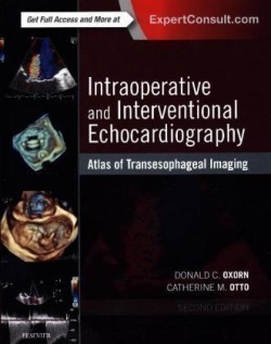 Intraoperative and Interventional Echocardiography : Atlas of Transesophageal Imaging
