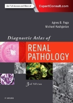 Diagnostic Atlas of Renal Pathology, 3rd Ed.