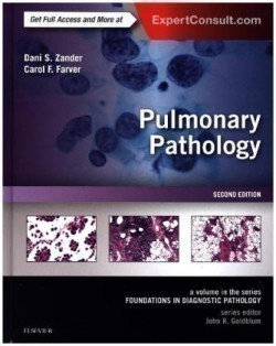 Pulmonary Pathology, 2nd Ed.