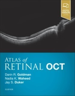 Atlas of Retinal OCT: Optical Coherence Tomography