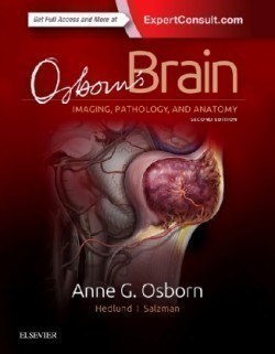 Osborn's Brain, 2nd rev Ed.