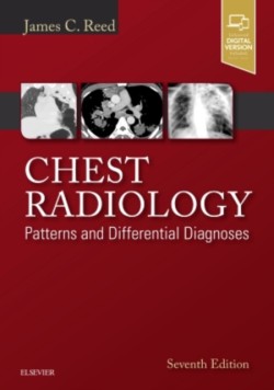 Chest Radiology Patterns and Differential Diagnoses