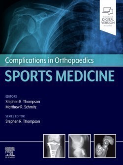 Complications in Orthopaedics: Sports Medicine