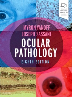 Ocular Pathology. 8th Ed.