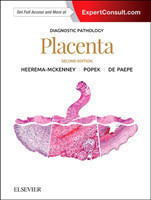 Diagnostic Pathology: Placenta, 2nd Ed.