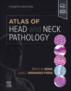 Atlas of Head and Neck Pathology, 4th ed.