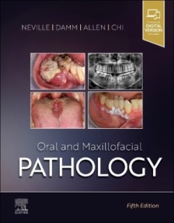 Oral and Maxillofacial Pathology, 5th ed.