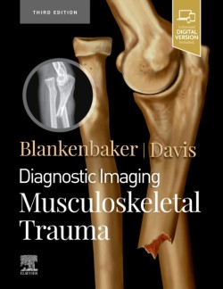 Diagnostic Imaging: Musculoskeletal Trauma, 3rd Ed.