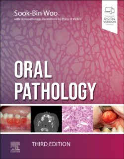 Oral Pathology, 3th ed.