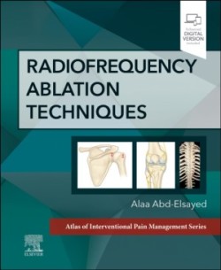 Radiofrequency Ablation Techniques