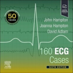 160 ECG Cases, 6th ed.