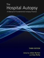 Hospital Autopsy