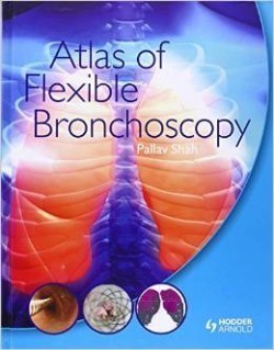 Atlas of Flexible Bronchoscopy