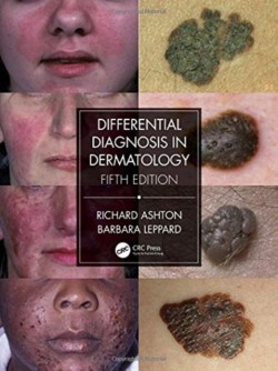 Differential Diagnosis in Dermatology