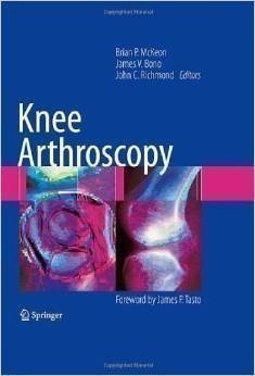 Knee Arthroscopy