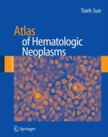 Atlas of Hematologic Neoplasms