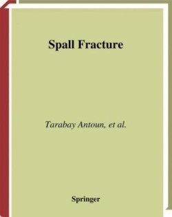 Spall Fracture