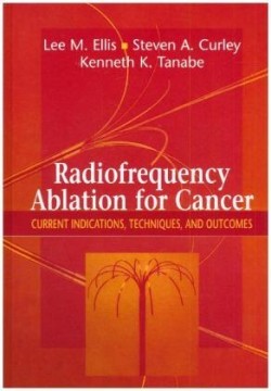 Radiofrequency Ablation for Cancer