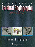 Diagnostic Cerebral Angiography