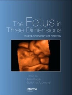 Fetus in Three Dimensions