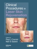 Clinical Procedures in Laser Skin Rejuvenation