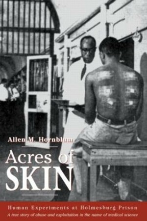 Acres of Skin