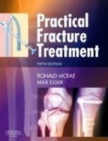 Practical Fracture Treatment