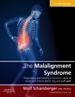 Malalignment Syndrome