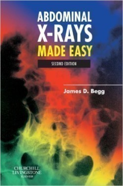 Abdominal X-rays Made Easy, 2nd Ed.
