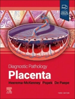 Diagnostic Pathology: Placenta, 3th ed.